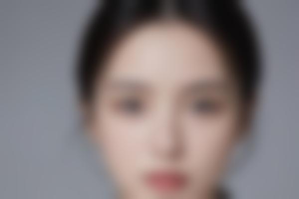 https://img.cnwenshen.com/machine/yimei/0b45e38a56cc18830e897d875f302b26223563310.jpg