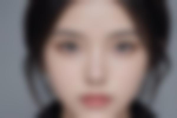 江阴红房子曹志金整形修复技术怎么样？自然精细化改善眼鼻问题超靠谱！