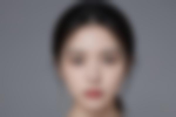 https://img.cnwenshen.com/machine/yimei/659bedd6b69654fabc0e4471905af36b242031809.jpg