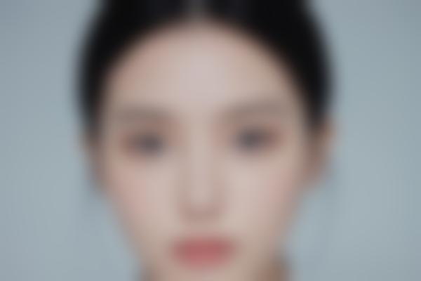 https://img.cnwenshen.com/machine/yimei/659bedd6b69654fabc0e4471905af36b546827037.jpg